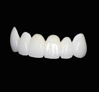 Zirconia Crowns