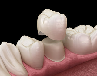 A Brief History of Dental Restoration