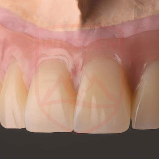 4D Multilayer zirconia 71mm system