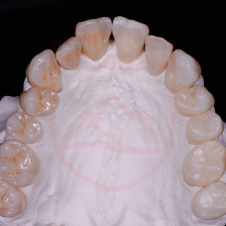 3D Multilayer zirconia 95mm system