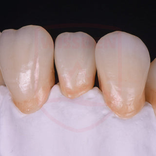 4D Multilayer zirconia 71mm system