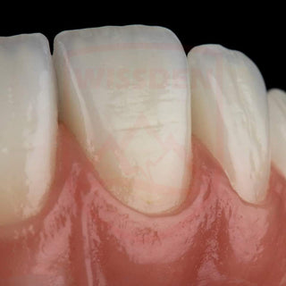 4D Multilayer zirconia 95mm system