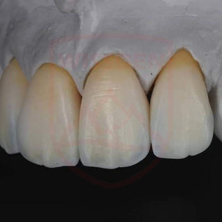 ST-C Pre-shaded zirconia 98mm system